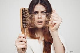 Why is my hair falling out? Lets talk about it!